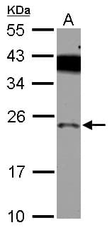 Polyclonal Rabbit anti-Human PRELID1 Antibody (IHC, WB)