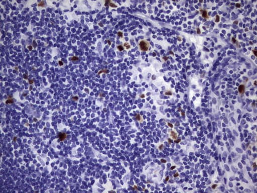 TOP2A / Topoisomerase II Alpha Antibody (aa1100-1531, clone UMAB145, Carrier-free)