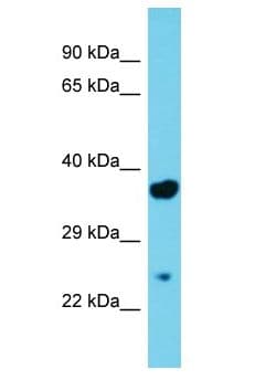 MGLL / Monoacylglycerol Lipase Antibody (aa41-90)