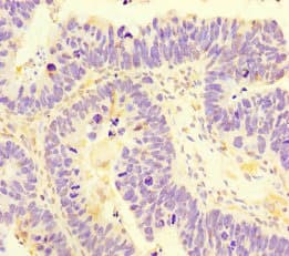 SAMD7 Antibody