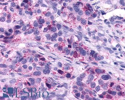 PathPlus™ Leukotriene B4 Receptor / BLT1 Antibody (C-Terminus)