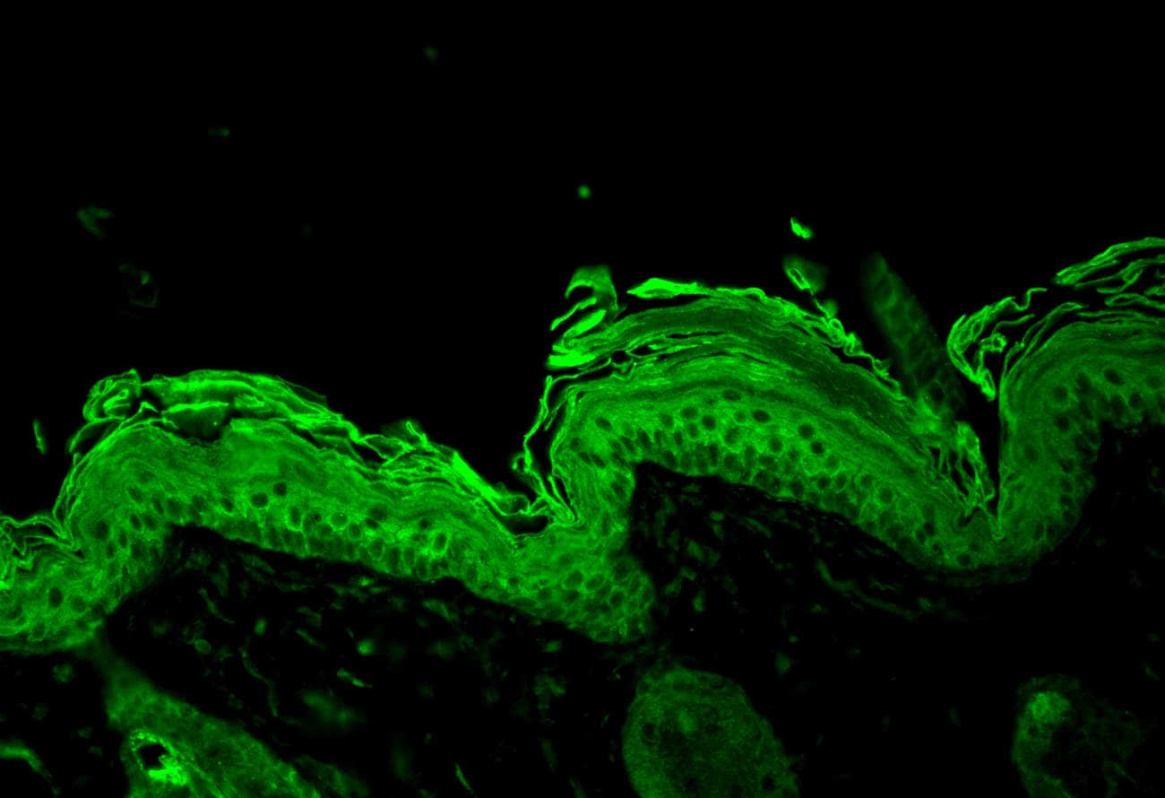 HSP90 / Heat Shock Protein 90 Antibody