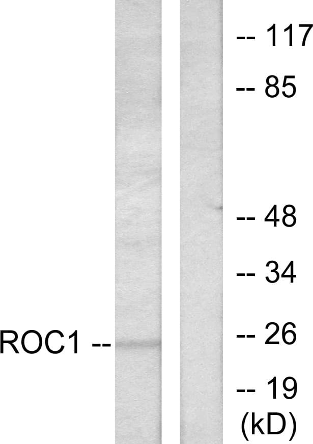 RIT1 Antibody (aa170-219)