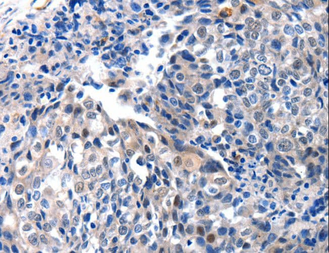 IGFBP7 / TAF Antibody
