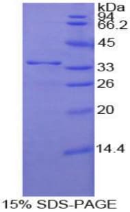 Human NUP205 Protein (Recombinant His-T7)