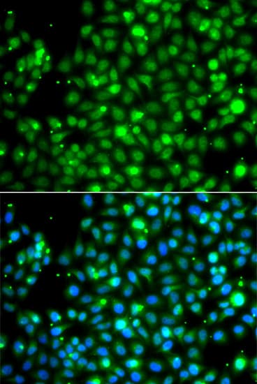 NME2 Antibody