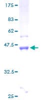 Human LMO4 Protein (Recombinant GST)