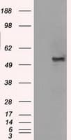 SLC2A5 / GLUT5 Antibody (clone OTI20E1)