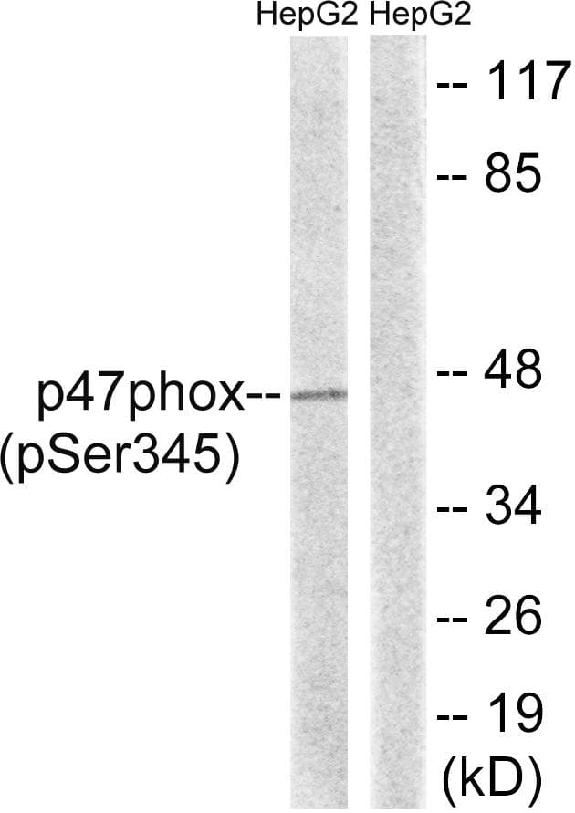 NCF1 / p47phox / p47 phox Antibody (phospho-Ser345)