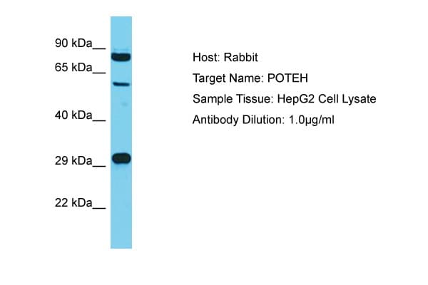 POTEH Antibody (aa421-470)
