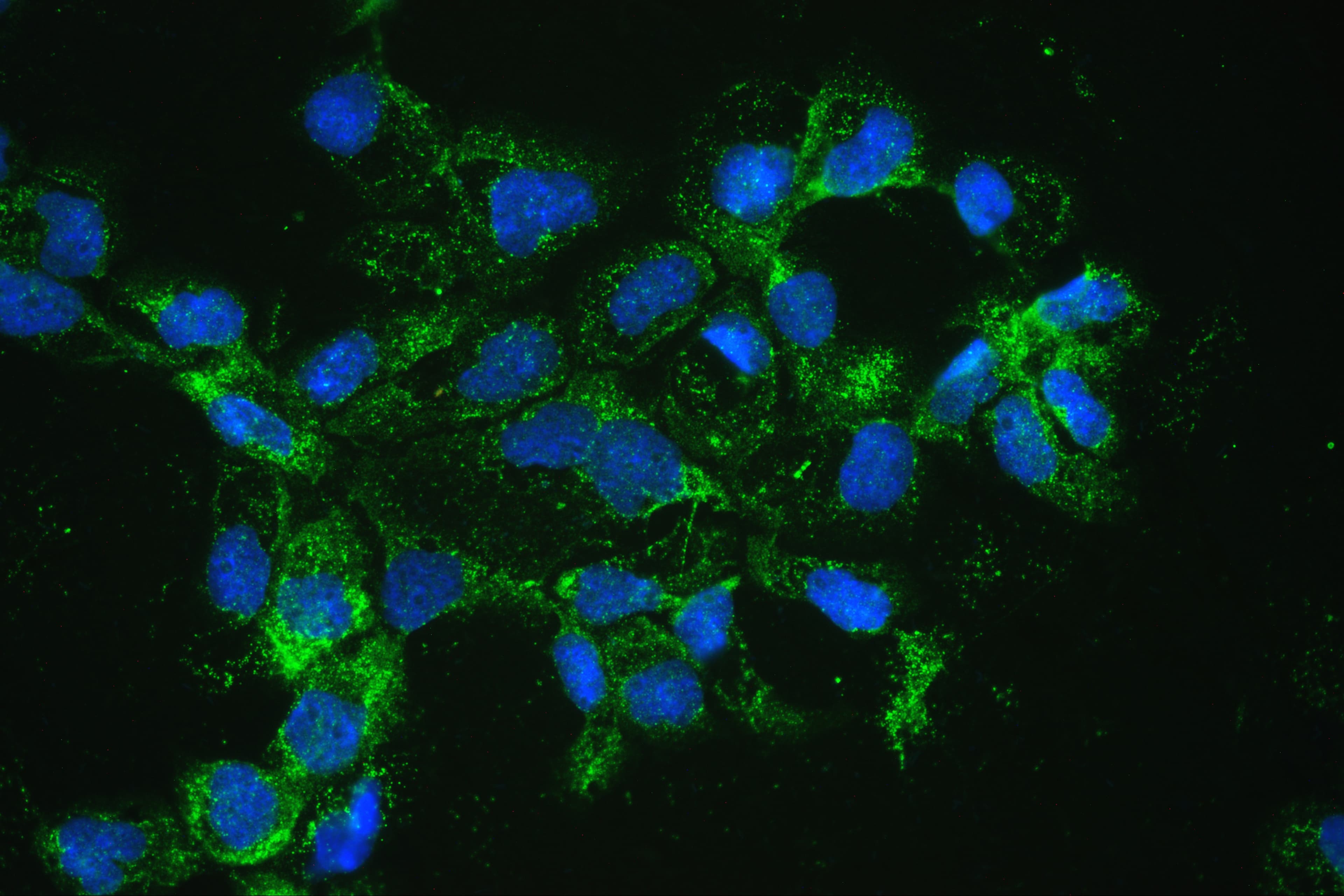 CAT / Catalase Antibody