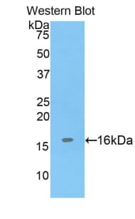 ADAMTS7 Antibody (aa447-578)