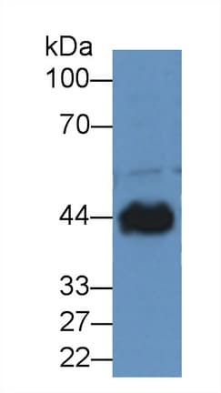 CKM / Creatine Kinase MM Antibody (aa11-367)