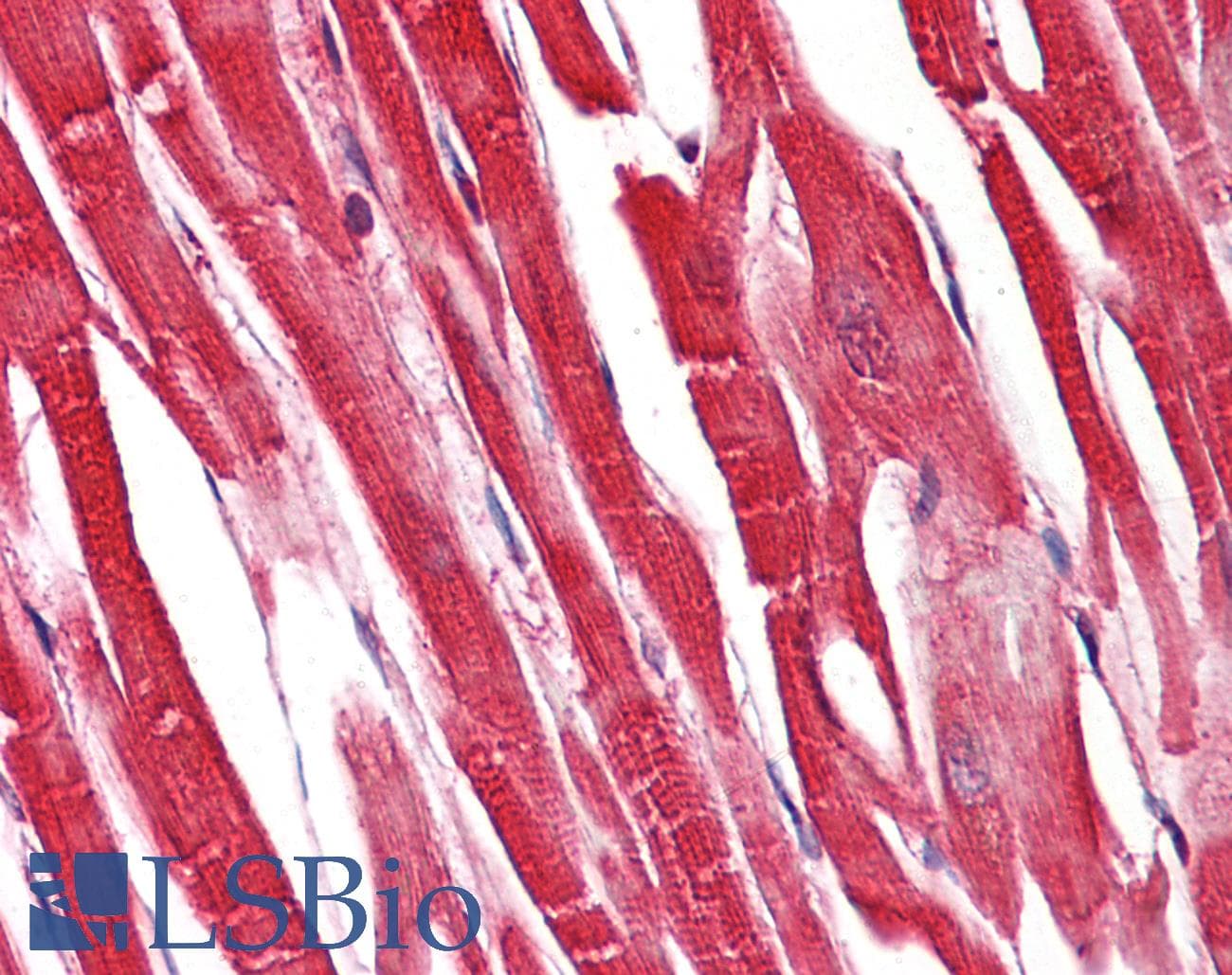 PathPlus™ Polyclonal Rabbit anti-Human S100A1 / S100-A1 Antibody (aa10-59, IHC, IF, WB)