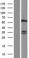 SNX27 Protein (Over-Expression Lysate Myc-DDK (Flag))