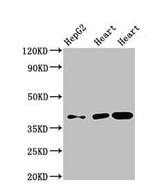 Polyclonal Rabbit anti-Human WISP3 Antibody (IHC, WB)