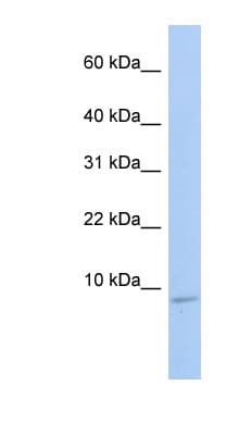 HSBP1 Antibody (N-Terminus)