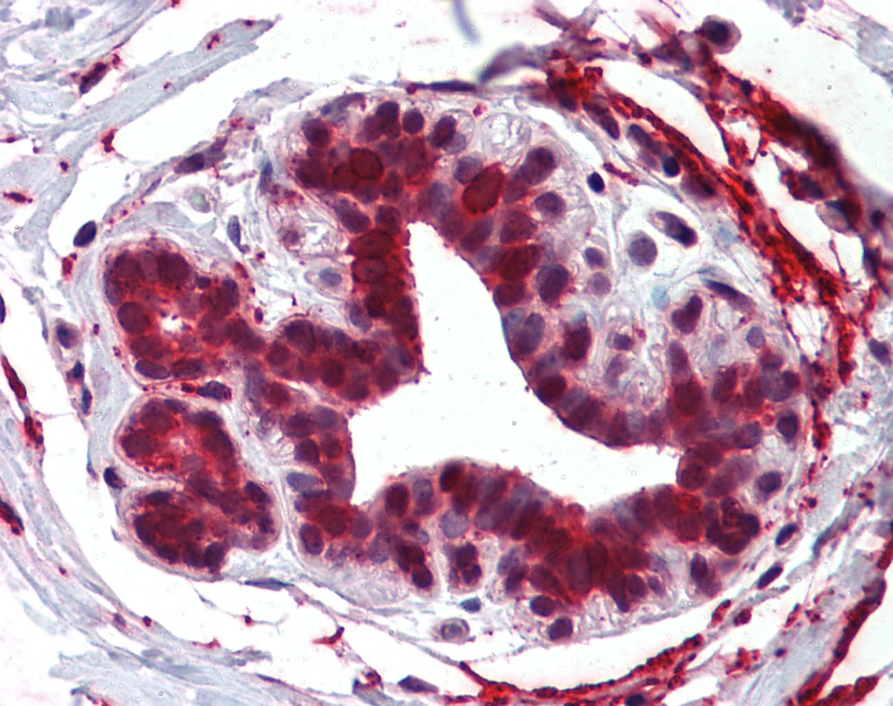 IHC-plus™ HELO1 / ELOVL5 Antibody (Internal)