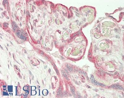 IHC-plus™ KDR / VEGFR2 / FLK1 Antibody (aa 20-764)