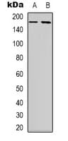 Polyclonal Rabbit anti-Human NBEAL1 Antibody (Internal, IHC, WB)
