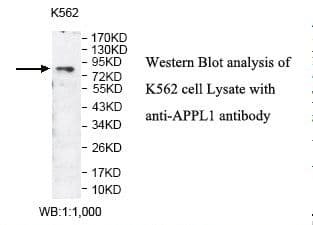 Polyclonal Rabbit anti-Human APPL1 / APPL Antibody (aa502-681, IHC, WB)
