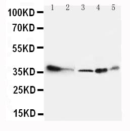 ANXA4 / Annexin IV Antibody (N-Terminus)