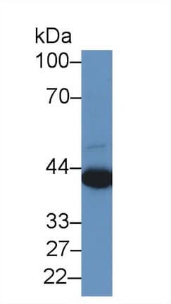 PRAME Antibody (aa416-502)
