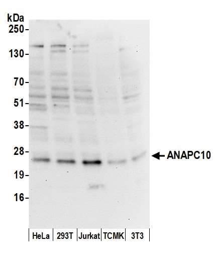 ANAPC10 / APC10 Antibody (aa1-50)
