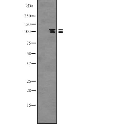 PKN3 Antibody
