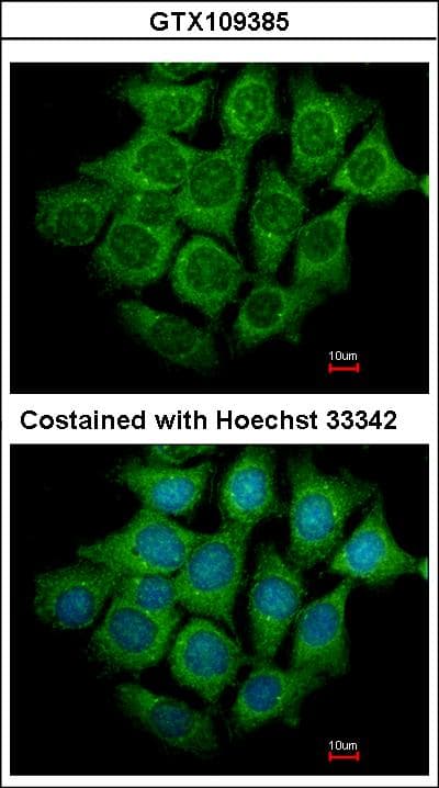 IHC-plus™ Polyclonal Rabbit anti-Human UFD2A / UBE4B Antibody (aa869-1179, IHC, WB)