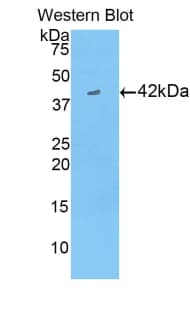 CKB / Creatine Kinase BB Antibody (aa11-367)