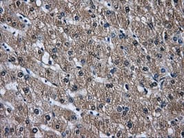 DCXR Antibody (clone OTI9C9)