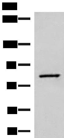 SLC26A3 / DRA Antibody