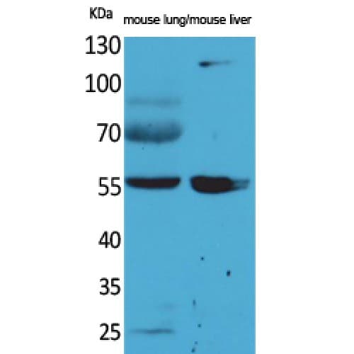 ALDH1A1 / ALDH1 Antibody (21-70 aa, N-terminal)