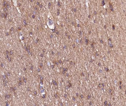 Endostatin Antibody
