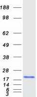Human BIRC5 / Survivin Protein (Recombinant Myc-DDK (Flag))