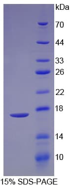 Rat Preprovasopressin Protein (Recombinant His)