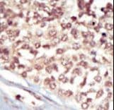 Polyclonal Rabbit anti-Human EPHA5 / EPH Receptor A5 Antibody (aa942-972, IHC, WB)