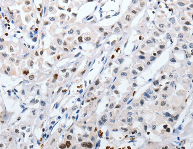 HSP70 / Heat Shock Protein 70 Antibody