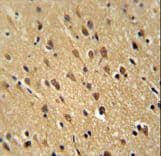 PFAS Antibody (aa184-213)