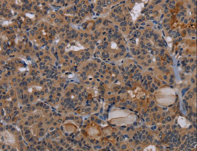 Polyclonal Rabbit anti-Human NPR2L / TUSC4 Antibody (IHC)