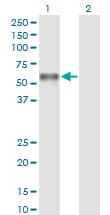PROC / Protein C Antibody (clone 3A10)