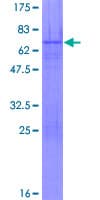 Human OTP Protein (Recombinant GST)