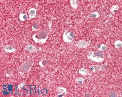 IHC-plus™ PIEZO2 / FAM38B Antibody