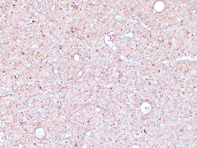 NF-L / NEFL Antibody (clone ABT-NF)