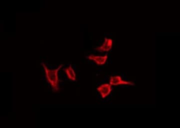 CORO1A / Coronin 1a Antibody