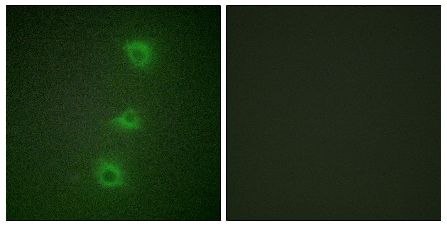 Polyclonal Rabbit anti-Human BRAF / B-Raf Antibody (IHC, IF, WB)