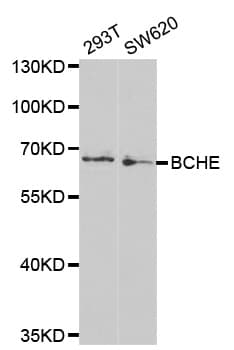 BCHE / Cholinesterase Antibody