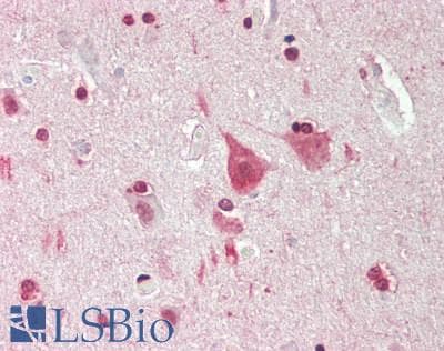 Polyclonal Rabbit anti-Mouse MXI1 / MAD2 Antibody (N-Terminus, IHC, WB)