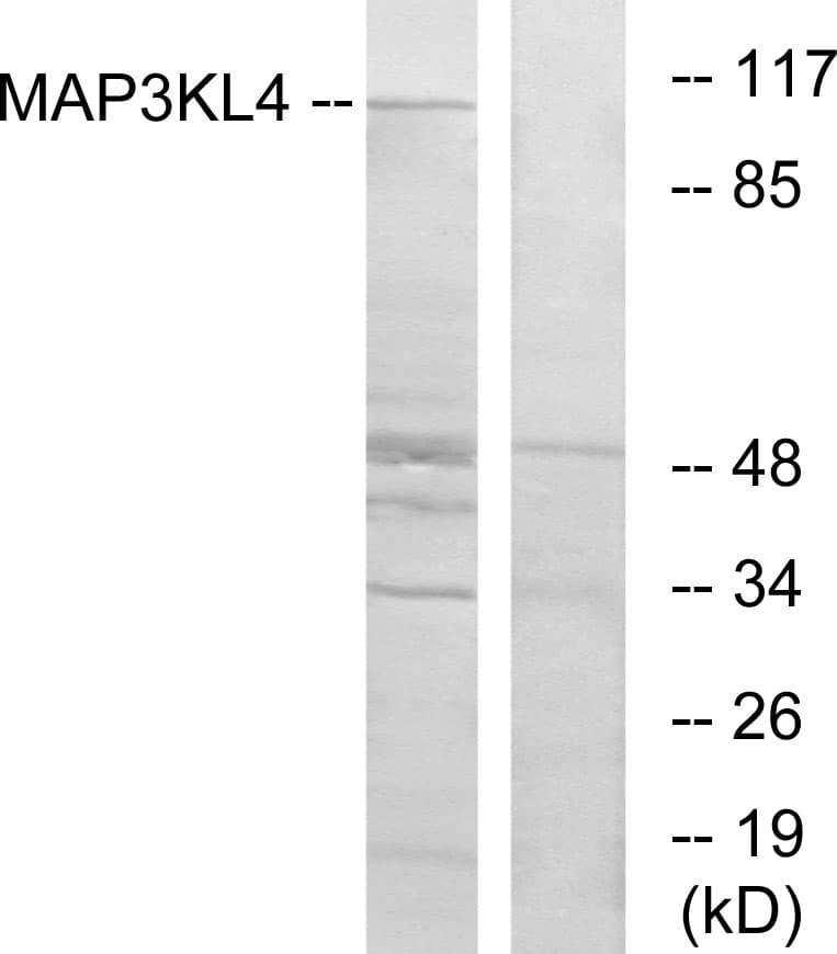 MLK4 / KIAA1804 Antibody (aa631-680)
